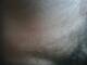 My pelo